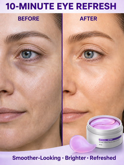 Retinol Berry Under-Eye Patches — Brighter, Plumper-Looking Eyes ✨
