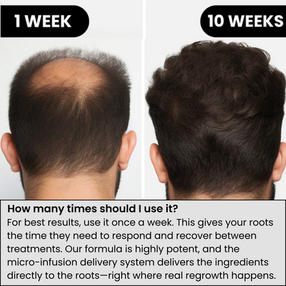 Hair Regrowth System