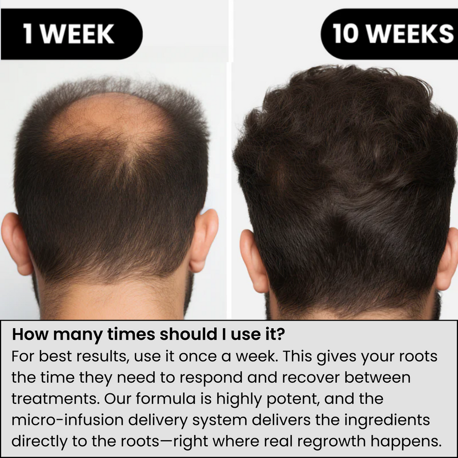 Once-weekly scalp care routine